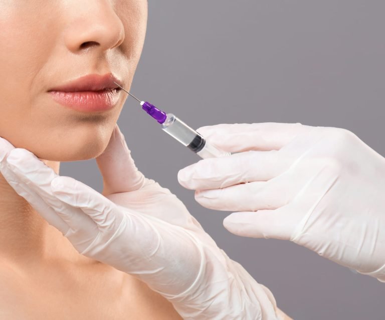 Lip Filler Injection